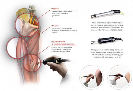 ASA HIRO 3.0 Аппарат лазерный терапевтический Hilterapia